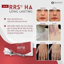 RRS HA Long Lasting